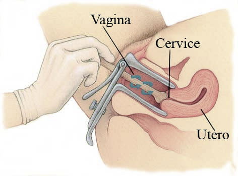 pap test